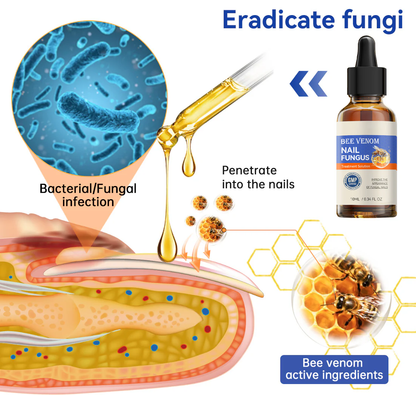 Bee Venom Nail Fungus Treatment Solution