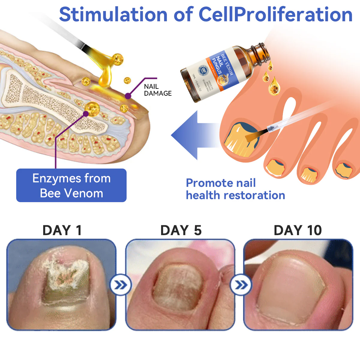 Bee Venom Nail Fungus Treatment Solution